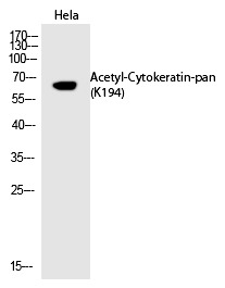 Anti-Acetyl-Cytokeratin-pan (Lys194) Polyclonal Antibody