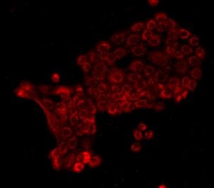 Anti-E-Cadherin/Cadherin-1 Antibody (7M374)