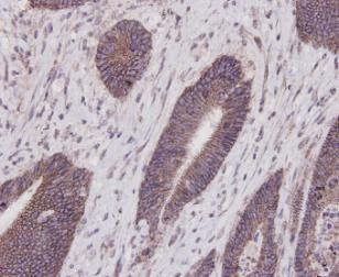 Anti-E-Cadherin/Cadherin-1 Antibody (7M374)