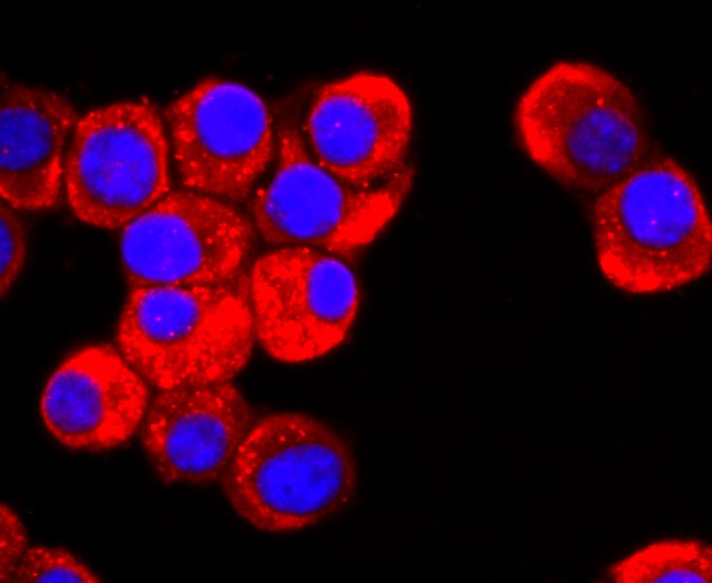 Anti-DRD1 Antibody (5S403)