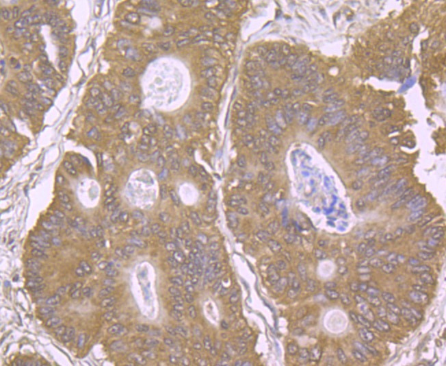 Anti-EAAT3 Antibody (2S513)