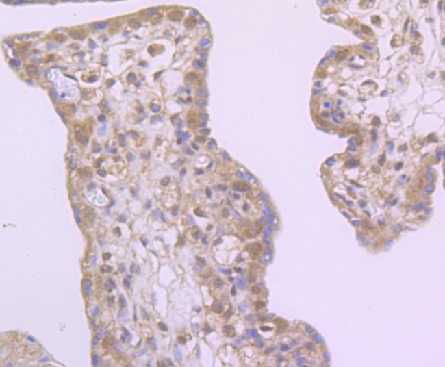 Anti-Drosha Antibody (5J107)