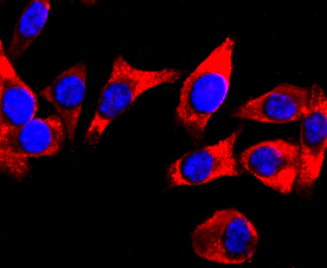 Anti-DRD1 Antibody (5S403)