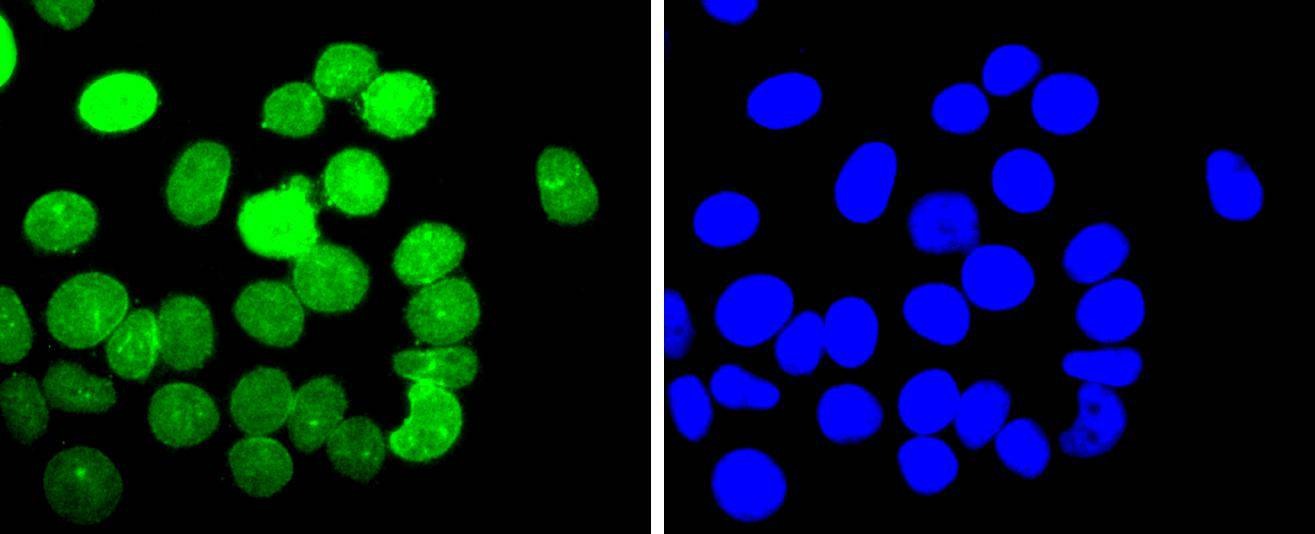 Anti-E2F1 Antibody (2K279)