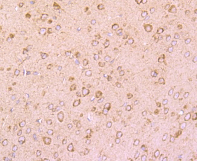 Anti-DRD1 Antibody (5S403)
