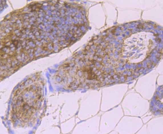 Anti-DSG1 Antibody (4J92)