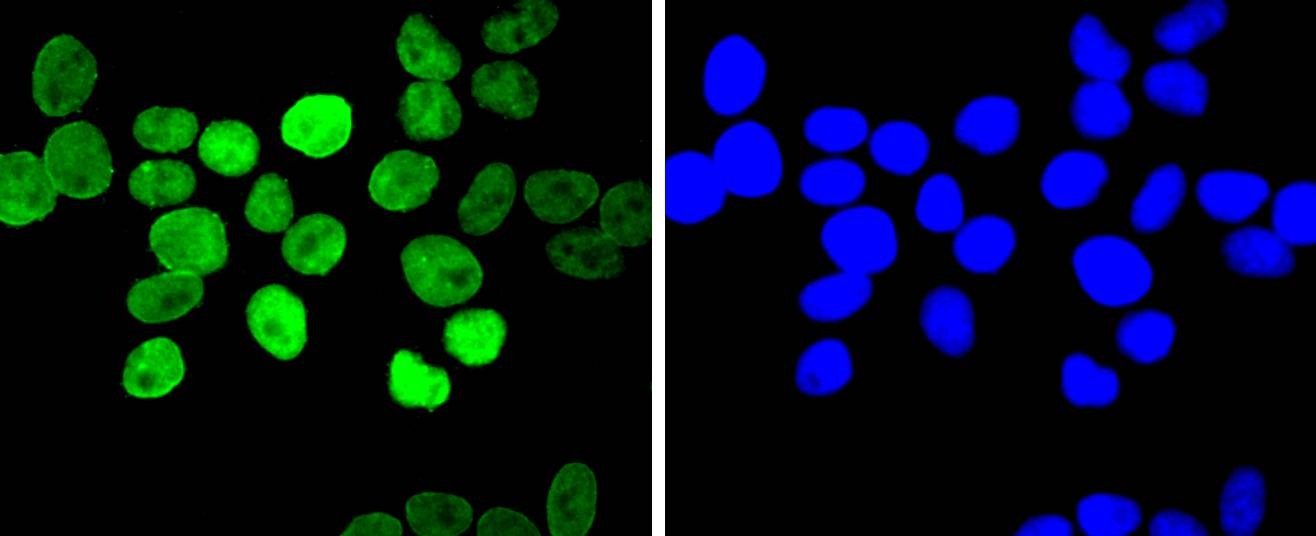 Anti-E2F1 Antibody (2K279)