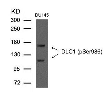 Anti-Phospho-DLC1 (Ser986) Polyclonal Antibody