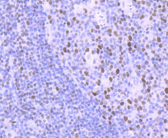 Anti-LIG1 Antibody (7P159)