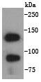 Anti-CDH1 Antibody (8F363)