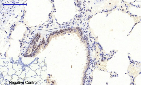 Anti-Phospho-MAPK3/1 (Thr202/Tyr204) Polyclonal Antibody