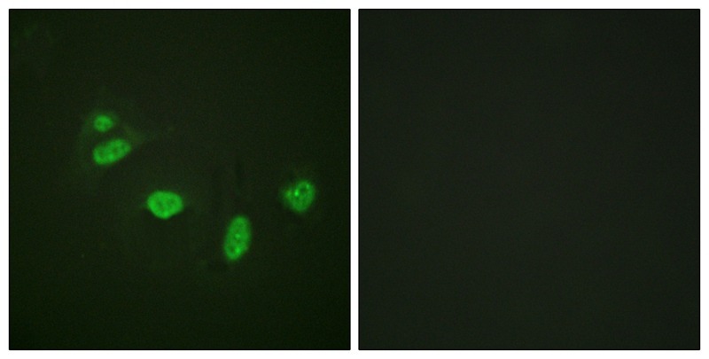 Anti-Phospho-ETS1 (Thr38) Polyclonal Antibody