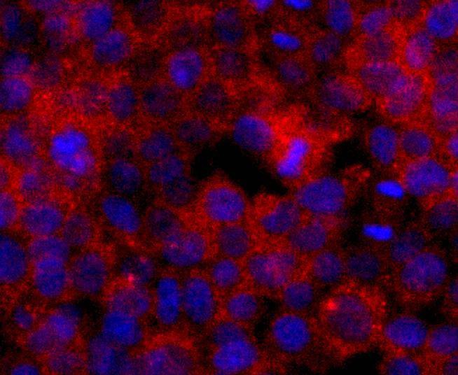 Anti-ERCC1 Antibody (7K54)
