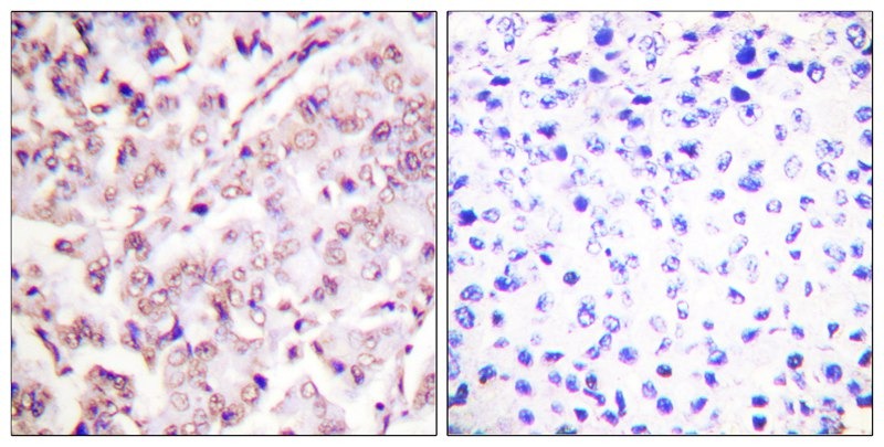 Anti-Phospho-ETS1 (Thr38) Polyclonal Antibody