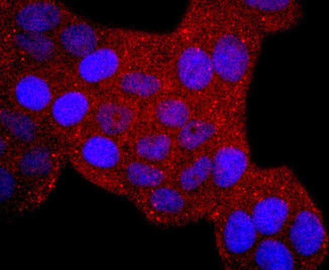 Anti-ERCC1 Antibody (7K54)