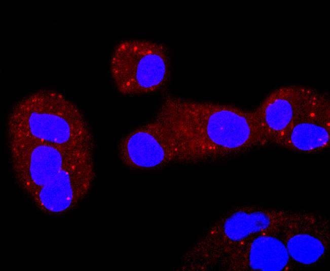Anti-ERCC1 Antibody (7K54)
