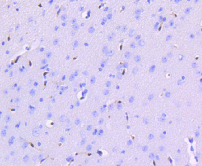 Anti-ERG Antibody (2Q359)