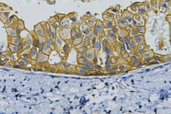 Anti-HER2/ERBB2 Antibody (9O395)