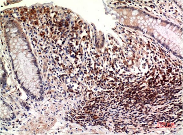 Anti-Epsilon Tubulin Antibody (3F495)