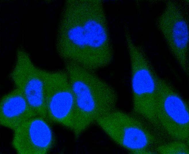 Anti-ERG Antibody (2Q359)
