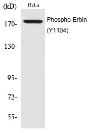 Anti-Phospho-Erbin (Tyr1104) Polyclonal Antibody