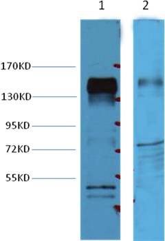 Anti-HER2/ERBB2 Antibody (9O395)