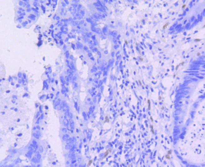 Anti-ERG Antibody (2Q359)