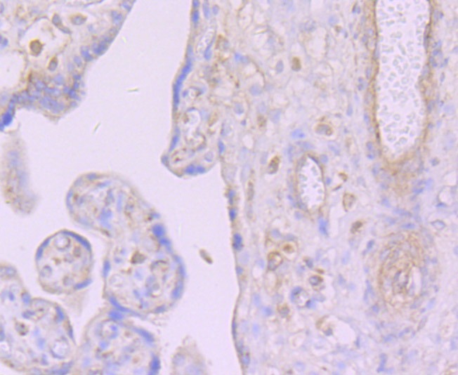 Anti-DCPLA Antibody (2R679)