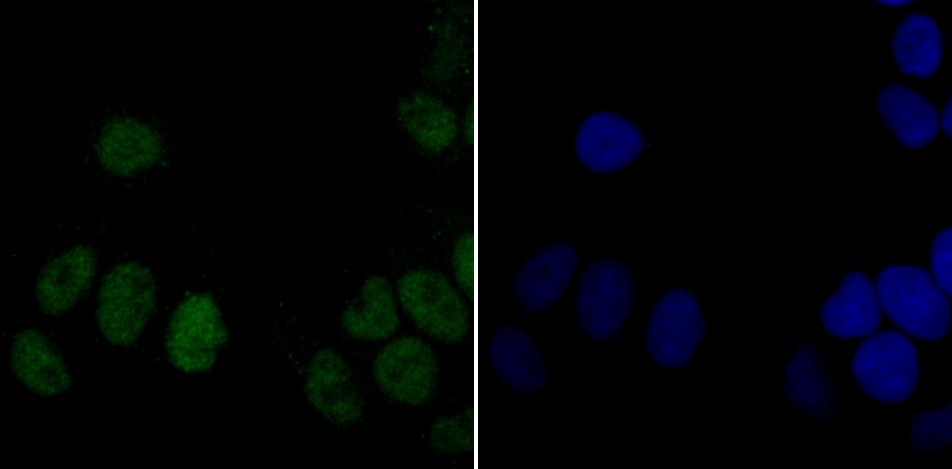 Anti-DDB1 Antibody (1Y859)