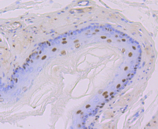Anti-DDB1 Antibody (1Y859)