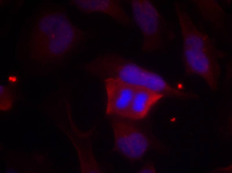 Anti-Phospho-DARPP-32 (Thr75) Polyclonal Antibody