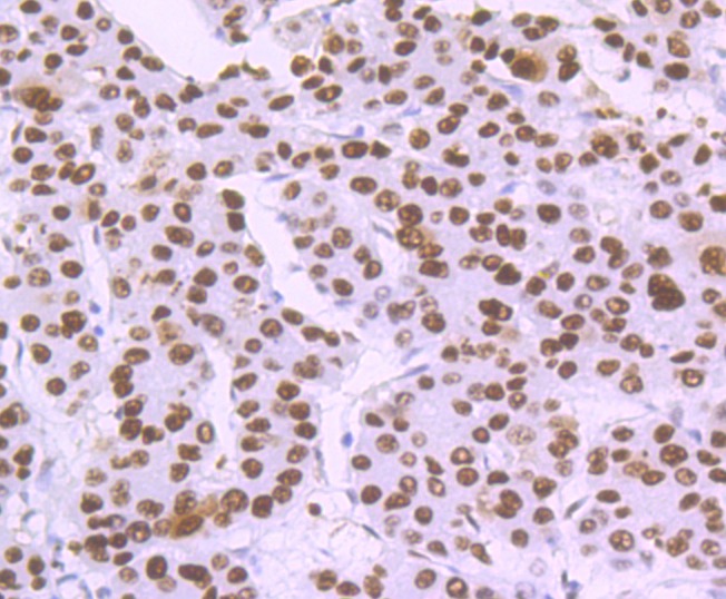 Anti-DDB2 Antibody (1O273)