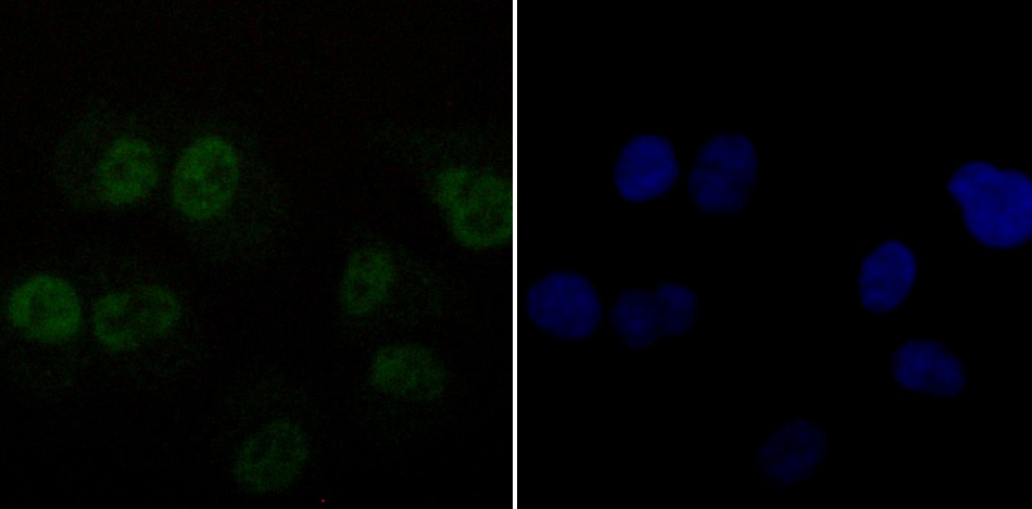Anti-DDB1 Antibody (1Y859)