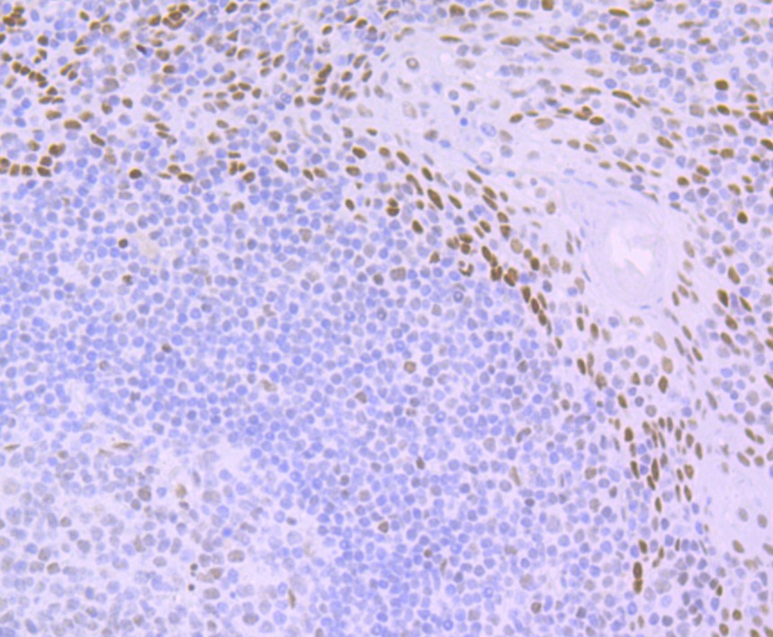 Anti-DDB2 Antibody (1O273)