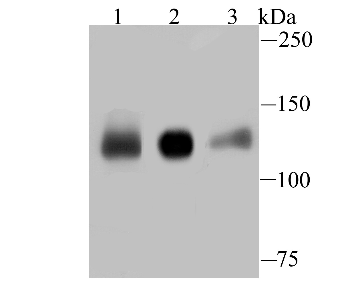 Anti-KIF11 Antibody (2W383)