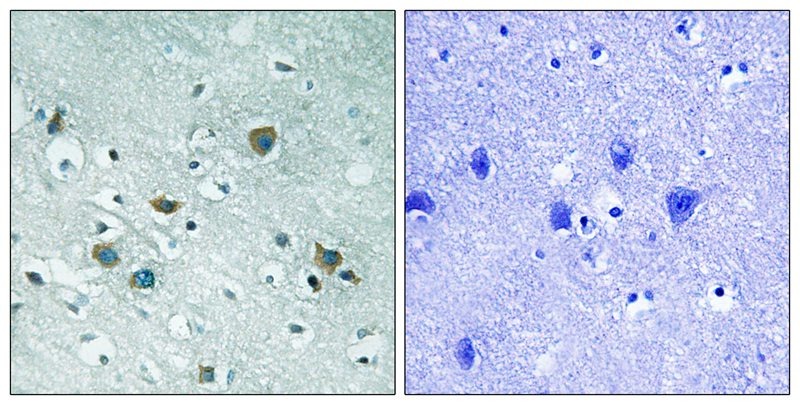 Anti-Phospho-DPYSL2 (Thr509) Polyclonal Antibody