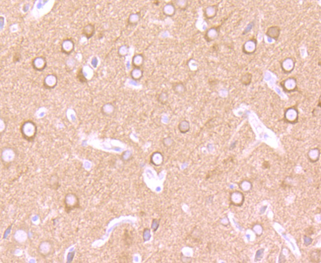 Anti-CRMP1 Antibody (1I169)