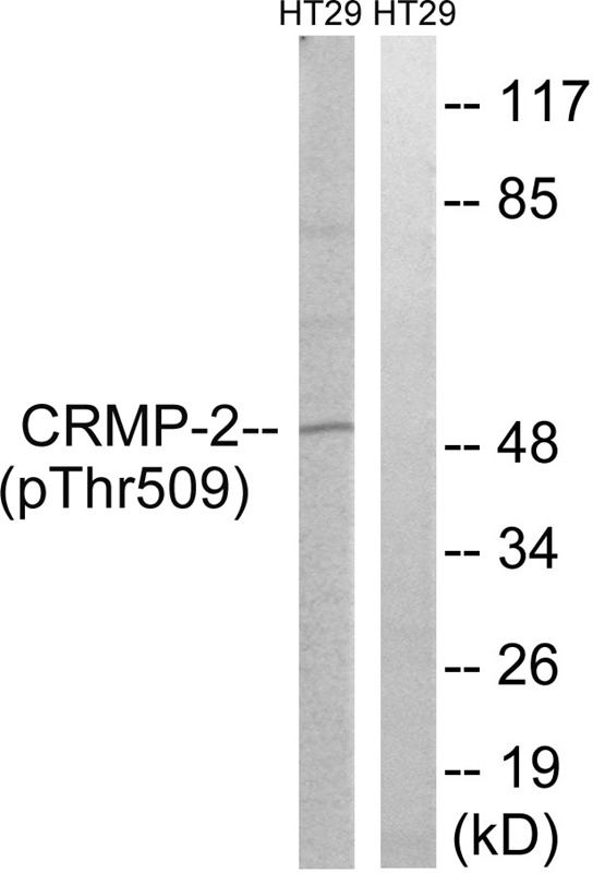 Anti-Phospho-DPYSL2 (Thr509) Polyclonal Antibody