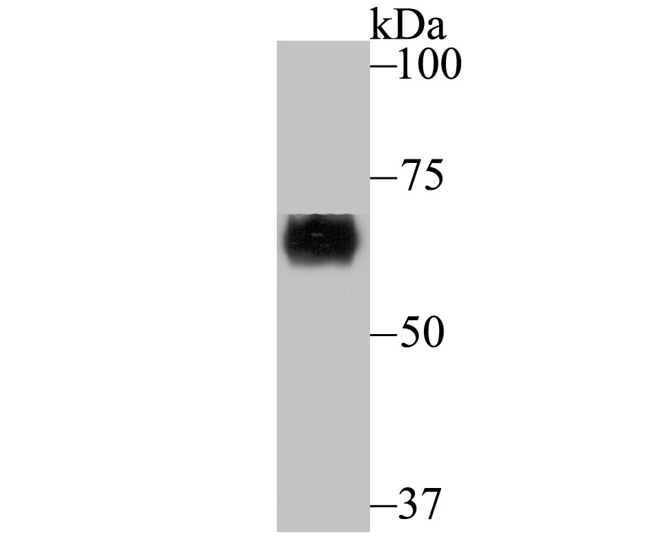 Anti-CRMP1 Antibody (1I169)