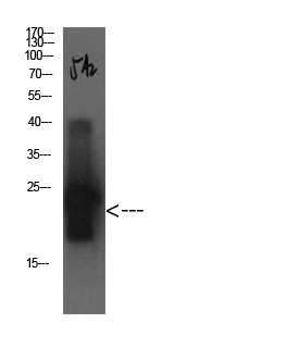 Anti-CST3 Antibody (3R866)
