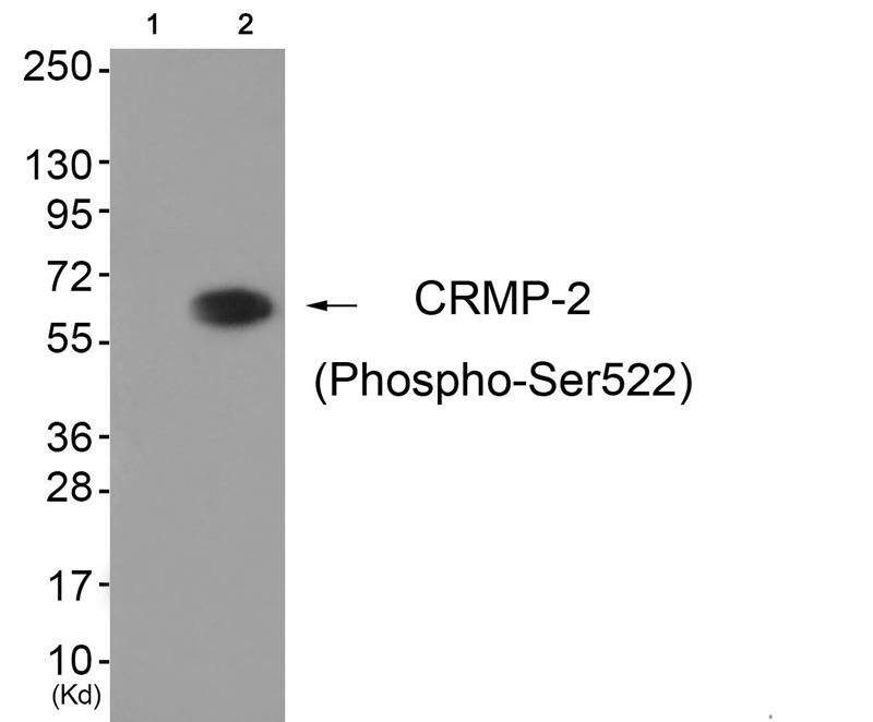 Anti-Phospho-DPYSL2 (Ser522) Polyclonal Antibody