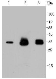 Anti-CCND1 Antibody (4L128)