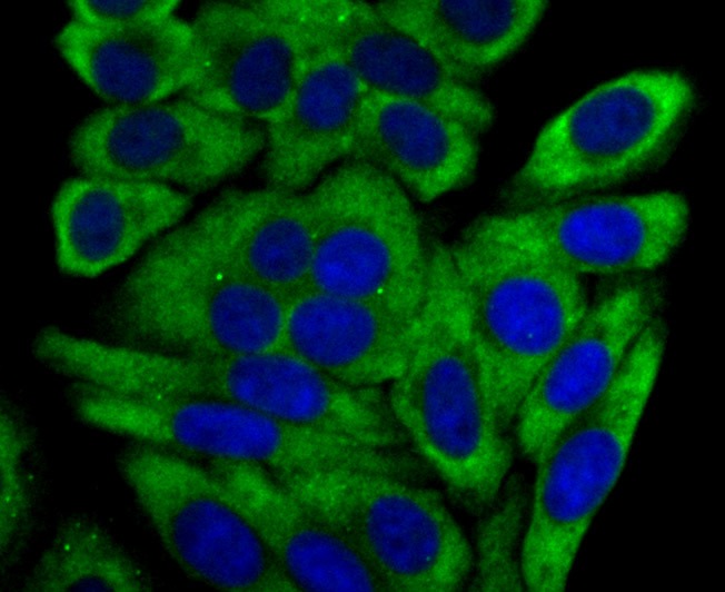 Anti-CYP17A1 Antibody (1U433)