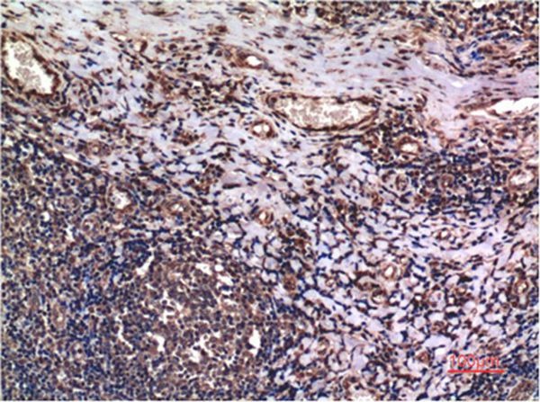 Anti-CCNB1 Antibody (5K945)