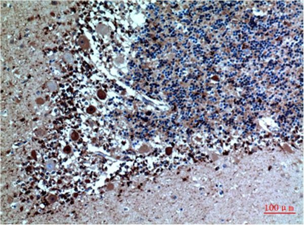Anti-CST3 Antibody (3R866)