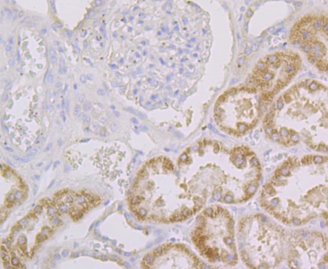 Anti-CYP27A1 Antibody (5U325)