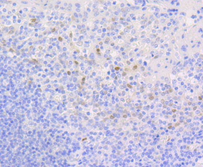 Anti-CCND1 Antibody (4L128)