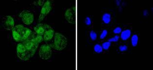 Anti-Cyclin E2 Antibody (2N277)