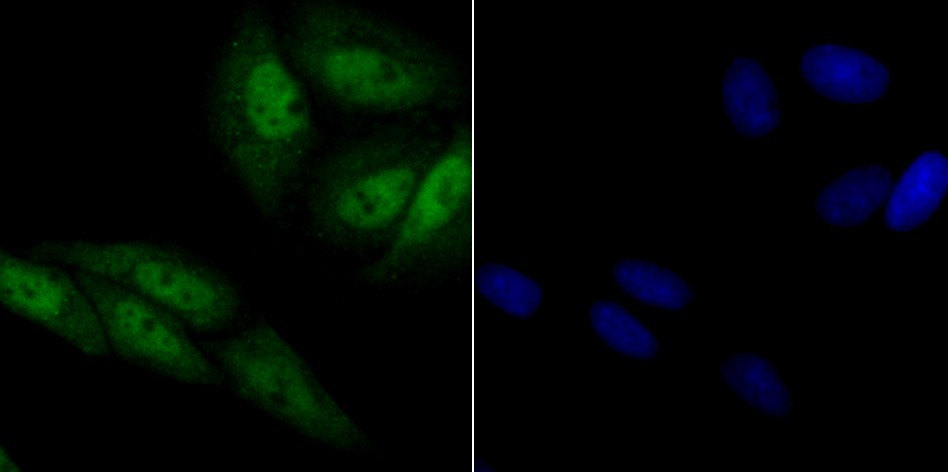 Anti-XPO1 Antibody (2H608)