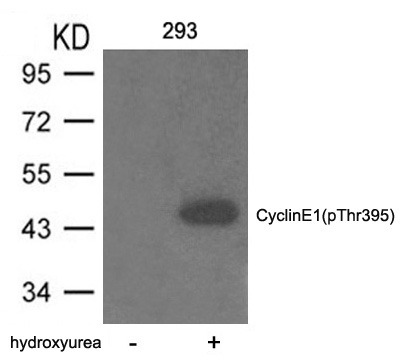 Anti-Phospho-CCNE1 (Thr395) Polyclonal Antibody